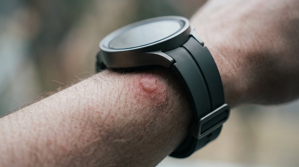 三星 Galaxy Watch 5 Pro 過熱致手腕水泡，專家籲睡前6項檢查